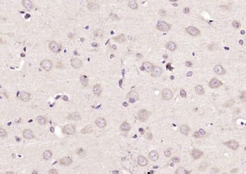MEG1 Polyclonal Antibody
