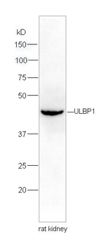 ULBP1 Polyclonal Antibody