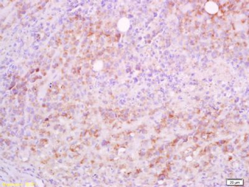 CD5L Polyclonal Antibody