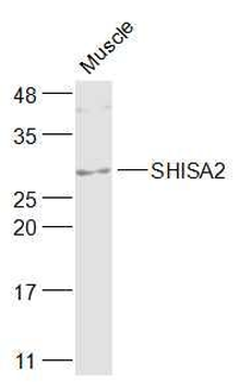 SHISA2 Polyclonal Antibody