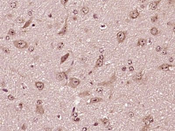 SHISA2 Polyclonal Antibody