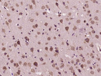 B4GALT6 Polyclonal Antibody