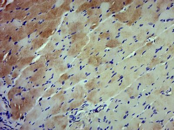 Growth hormone receptor Polyclonal Antibody