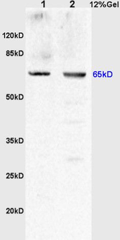 Uromucoid Polyclonal Antibody
