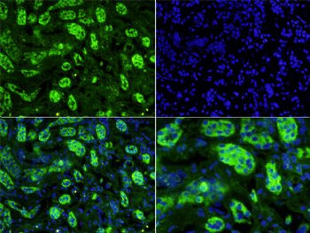 Uromucoid Polyclonal Antibody