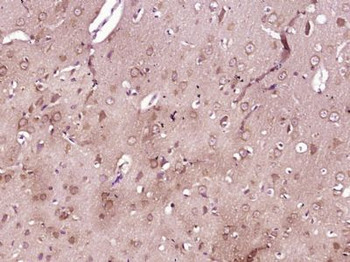 SLC36A2 Polyclonal Antibody