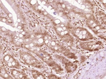 SH3BGRL3 Polyclonal Antibody