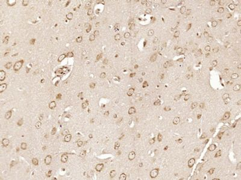 PAPD4 Polyclonal Antibody