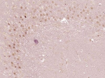 p66 beta/GATAD2B Polyclonal Antibody
