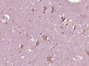 PPEF1 Polyclonal Antibody