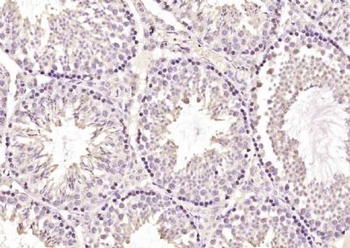 SLX4/BTBD12 Polyclonal Antibody