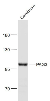 PAG3/ASAP2 Polyclonal Antibody