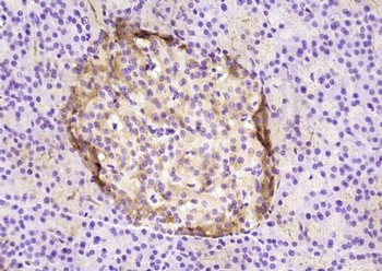 PAG3/ASAP2 Polyclonal Antibody