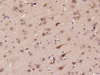 ASB5 Polyclonal Antibody