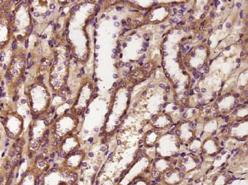 ASB5 Polyclonal Antibody