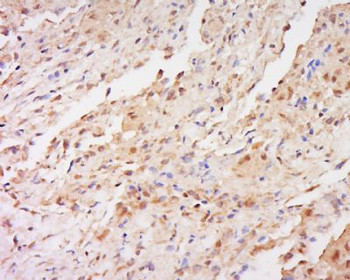 FAM166A Polyclonal Antibody