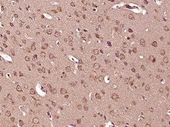 Tyrosine Hydroxylase Polyclonal Antibody