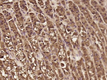 PPP1R11 Polyclonal Antibody