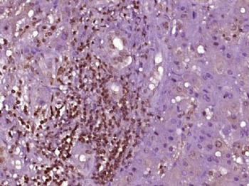 PRDM7 Polyclonal Antibody