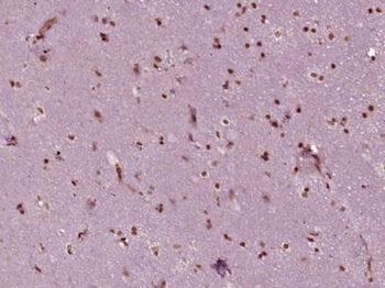 PBXIP1 Polyclonal Antibody