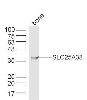 SLC25A38 Polyclonal Antibody