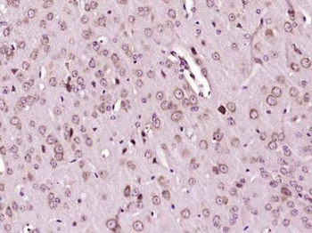 Histone binding protein/SLBP Polyclonal Antibody