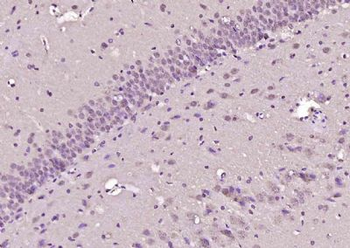 RBMXL1 Polyclonal Antibody