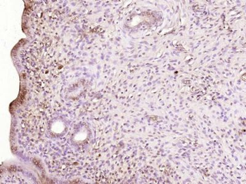 RBM47 Polyclonal Antibody