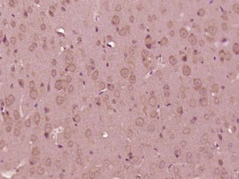 RBM25 Polyclonal Antibody