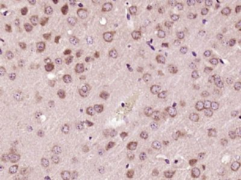 SH3BP1 Polyclonal Antibody