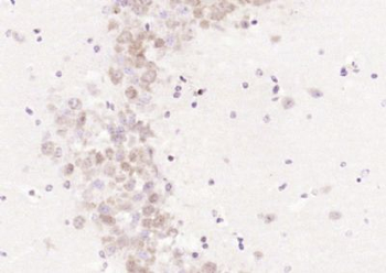 LCAT Polyclonal Antibody