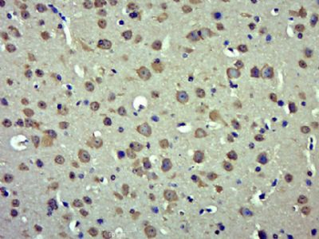 RAB30 Polyclonal Antibody