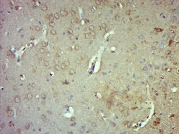 R3HCC1 Polyclonal Antibody