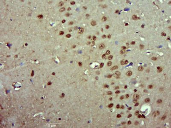 Pygopus 2 Polyclonal Antibody