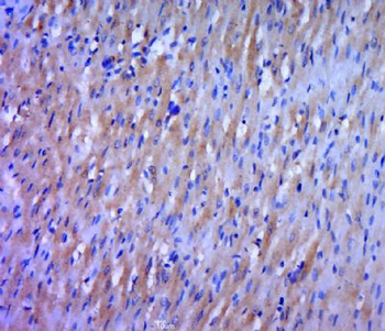 WRCH1 Polyclonal Antibody