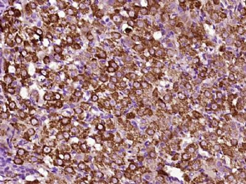 PRSS35 Polyclonal Antibody
