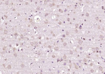 SAH3 Polyclonal Antibody
