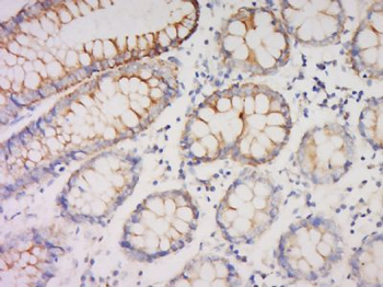 NRAP Polyclonal Antibody