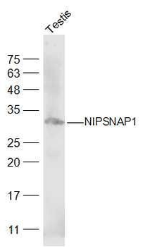 NIPSNAP1 Polyclonal Antibody