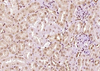 ZFP472 Polyclonal Antibody