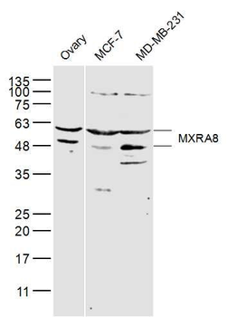 MXRA8 Polyclonal Antibody
