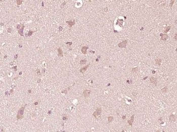 NDUFB1 Polyclonal Antibody