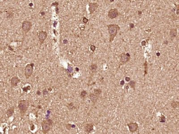 NBPF8 Polyclonal Antibody