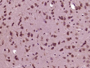 RRNAD1 Polyclonal Antibody