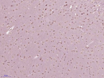 MBTD1 Polyclonal Antibody