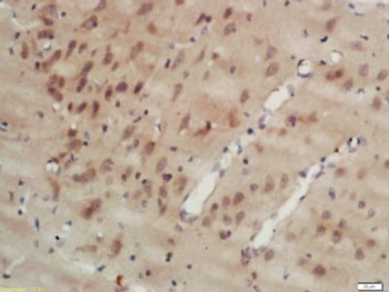 MAPRE1 Polyclonal Antibody