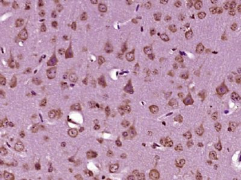 MAGT1 Polyclonal Antibody