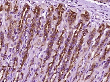 MAGT1 Polyclonal Antibody