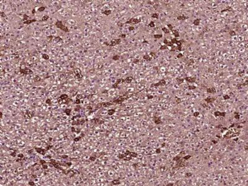 SARDH Polyclonal Antibody