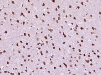 MACROD2/C20orf133 Polyclonal Antibody